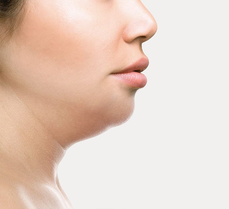 Double chin treatment ascot double chin treatment berkshire london